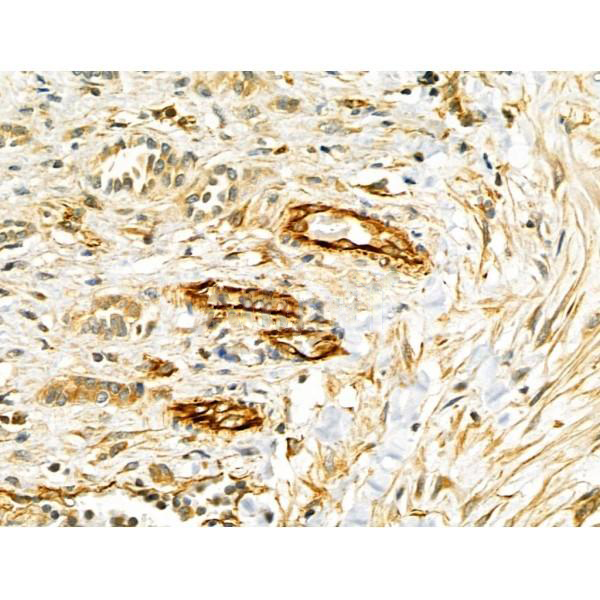 Donkey Anti-Goat IgG antibody (HRP). GTX232040-01