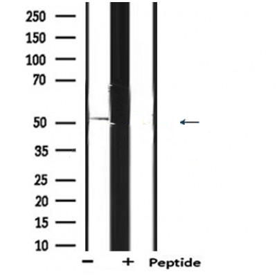 Donkey Anti-Goat IgG antibody (HRP). GTX232040-01