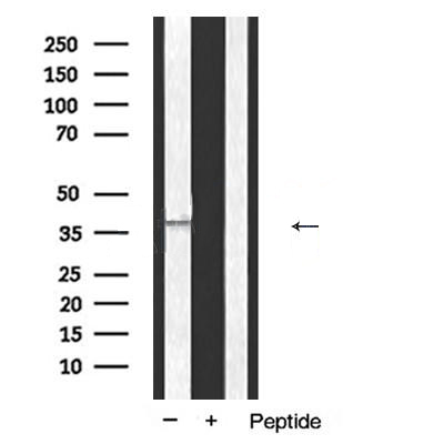 Donkey Anti-Goat IgG antibody (HRP). GTX232040-01