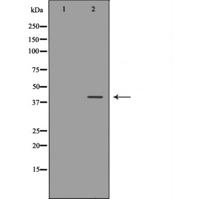 Donkey Anti-Goat IgG antibody (HRP). GTX232040-01