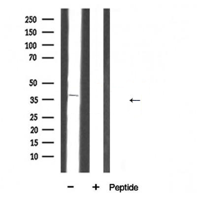 Donkey Anti-Goat IgG antibody (HRP). GTX232040-01