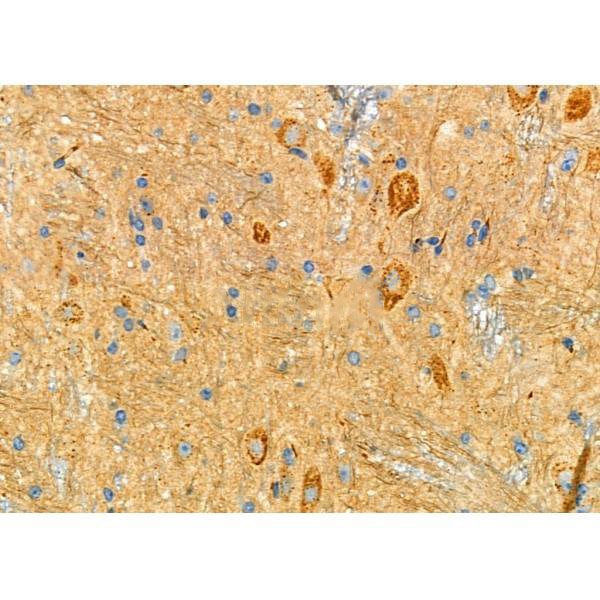 Donkey Anti-Goat IgG antibody (HRP). GTX232040-01