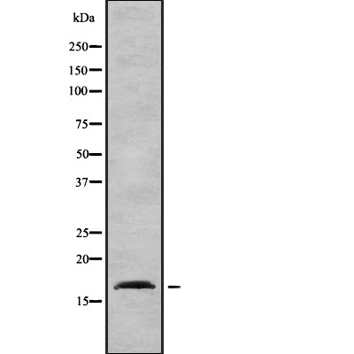 Donkey Anti-Goat IgG antibody (HRP). GTX232040-01