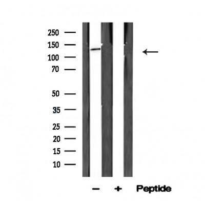Donkey Anti-Goat IgG antibody (HRP). GTX232040-01
