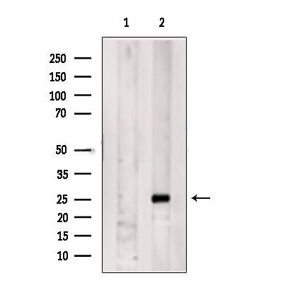 Donkey Anti-Goat IgG antibody (HRP). GTX232040-01