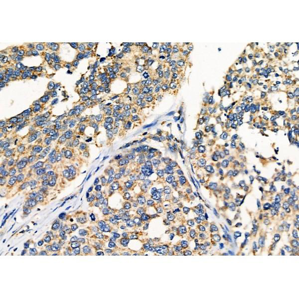 Donkey Anti-Goat IgG antibody (HRP). GTX232040-01